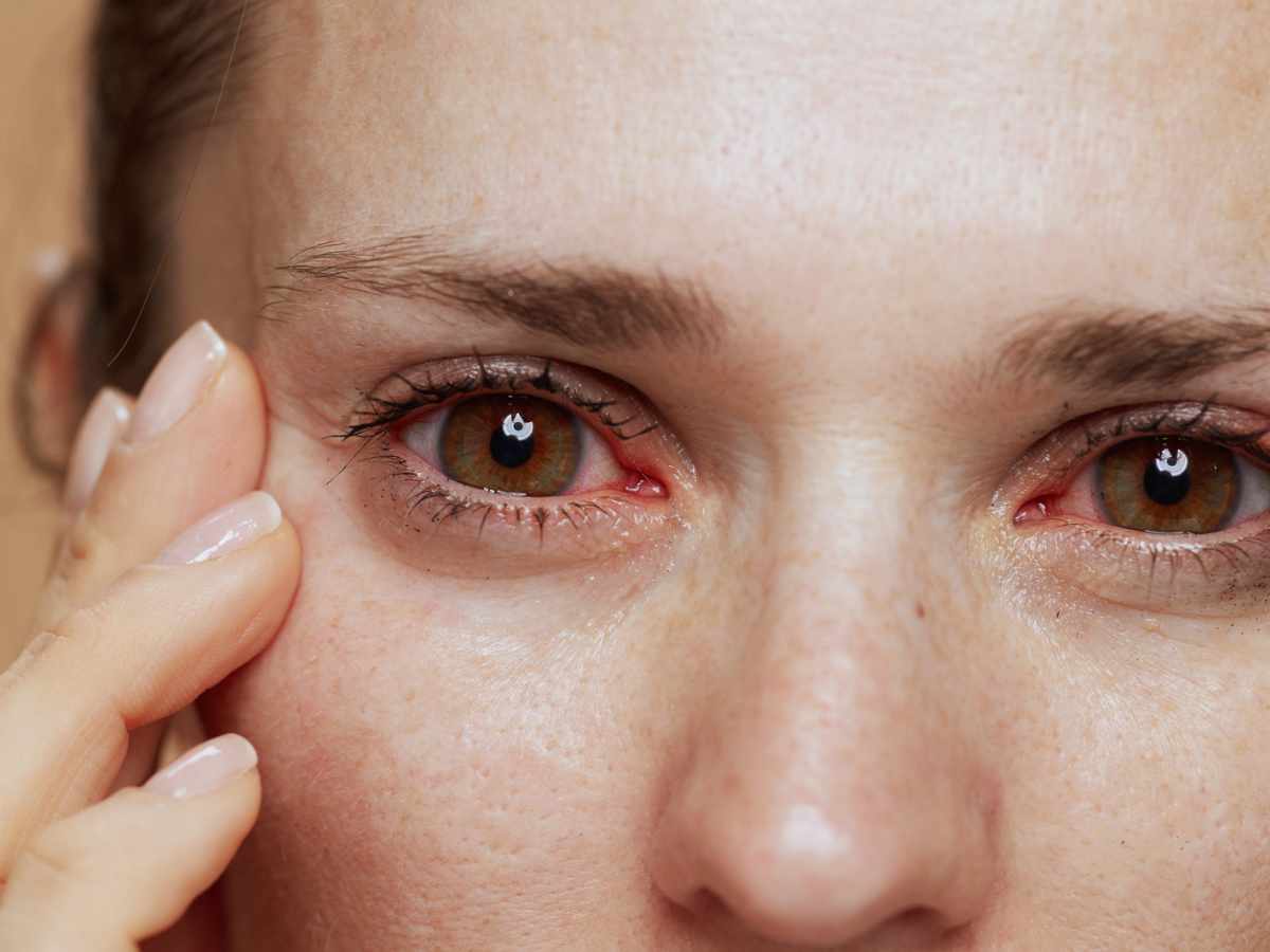 Unseen Impact: How Sleep Deprivation Affects Your Eyesight